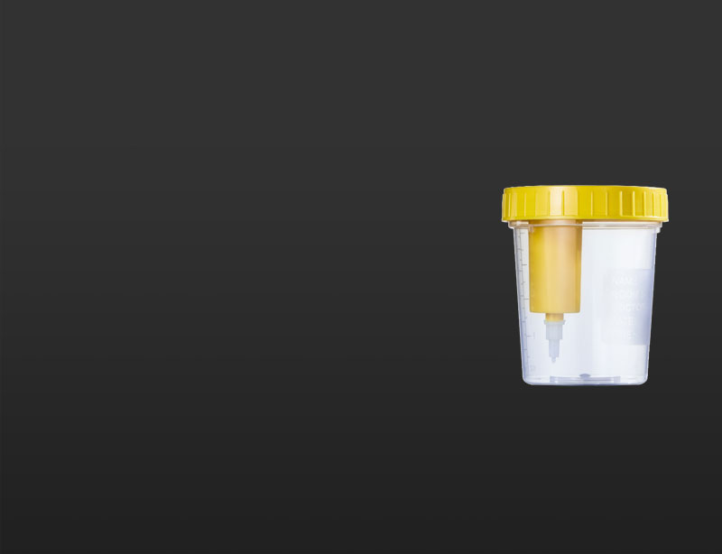 contenitore-per-urine